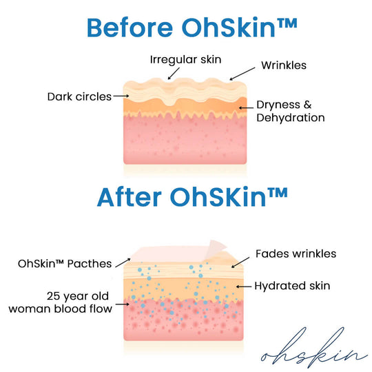 The OhSkin™ Patches : Say goodbye to your wrinkles now !